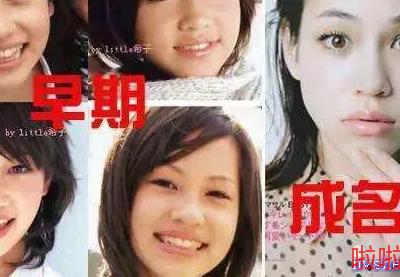 日式整容和韩式整容有什么区别 极致美与自然美