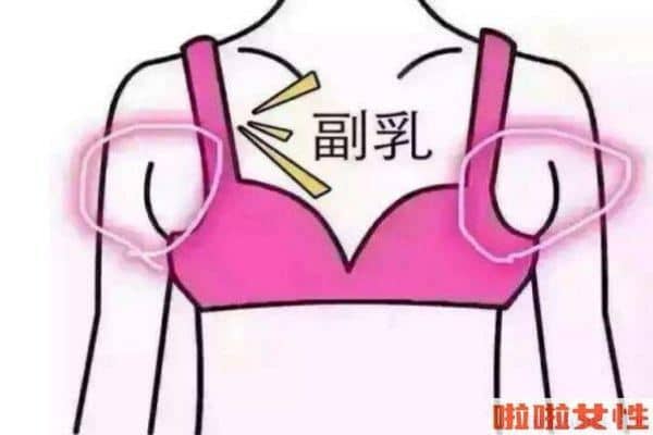 如何去副乳的方法 减掉副乳的最快方法